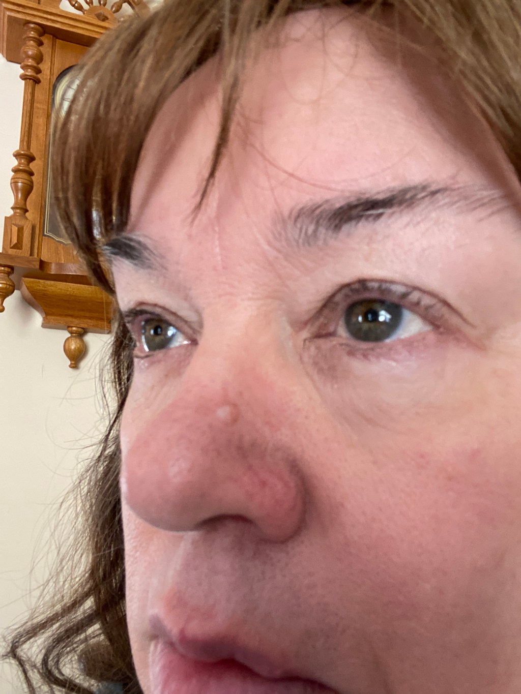 PSA: Get that skin spot checked&nbsp;out!